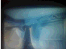 5379231 FIAT Tempra 1900d